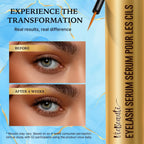 VieBeauti EyeLash Growth Serum for Longer Fuller Thicker Looking Lashes 5 mL