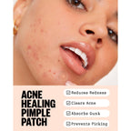PEACE OUT Acne Healing Dots Hydrocolloid Pimple Patches (60 count) | Fast Acting Acne Spot Treatment for Blemishes & Breakouts with Salicylic Acid, Retinol and Aloe Vera, Award Winning Skincare