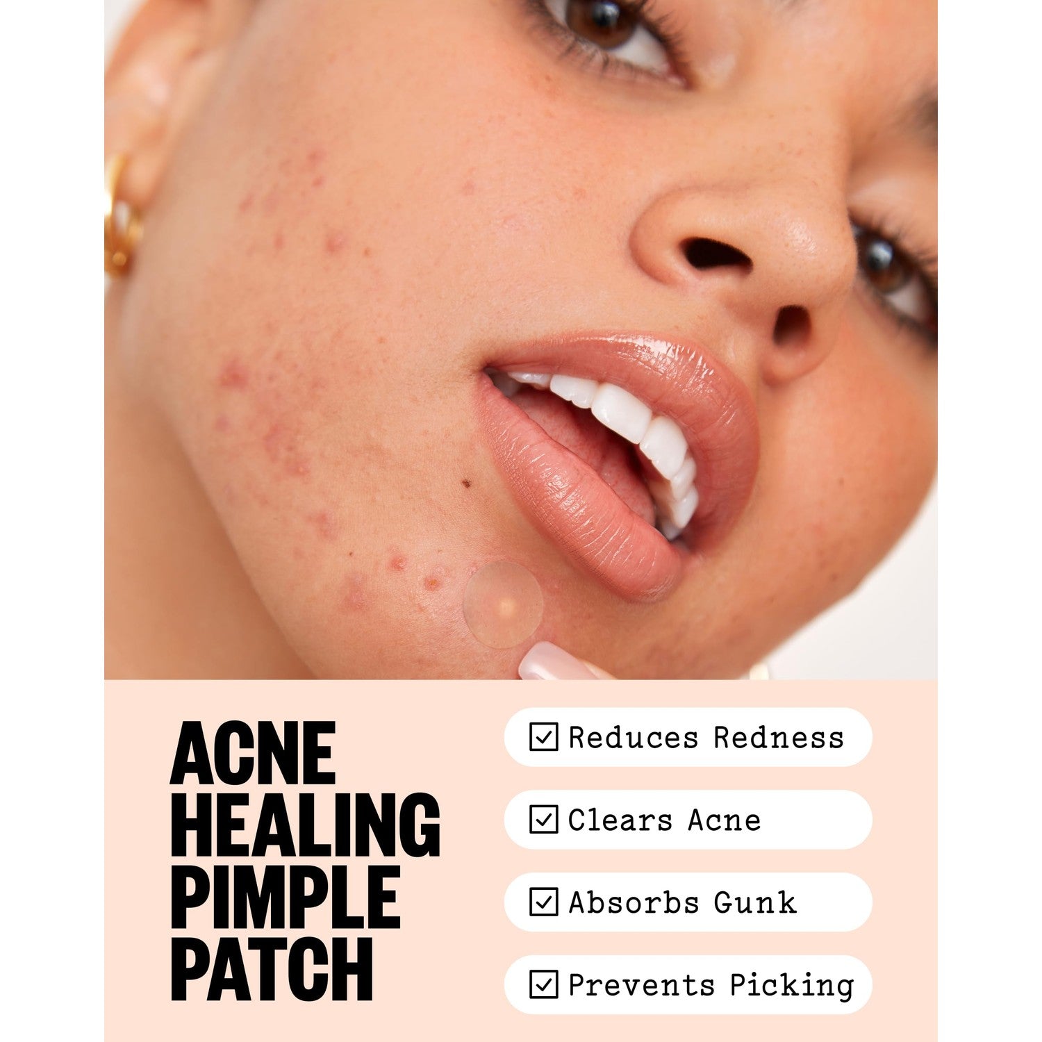 PEACE OUT Acne Healing Dots Hydrocolloid Pimple Patches (60 count) | Fast Acting Acne Spot Treatment for Blemishes & Breakouts with Salicylic Acid, Retinol and Aloe Vera, Award Winning Skincare