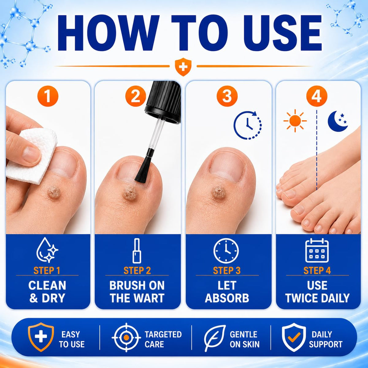 FLYLEAF 40% Salicylic Acid Wart Remover Liquid, Fast-Acting Maximum Strength Plantar Wart Remover for Common, Flat & Foot Warts, Corns & Calluses, Hands, Feet, Toes & Soles, 1.01 fl oz