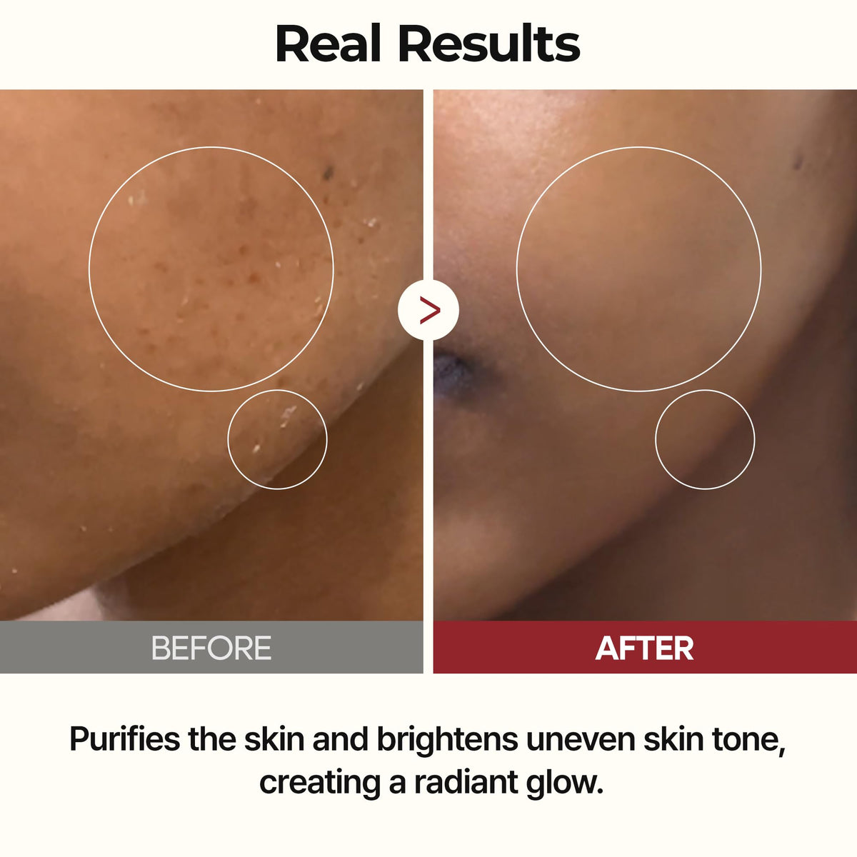Dr.Melaxin Peel Shot Glow Rice Toner with Rice Extract & Ceramides, Hydrating & Skin Refining Face Toner for Glass Skin, Liposome Oil for Deep Moisture & Barrier Care, Korean Skincare, 6.76 fl.oz