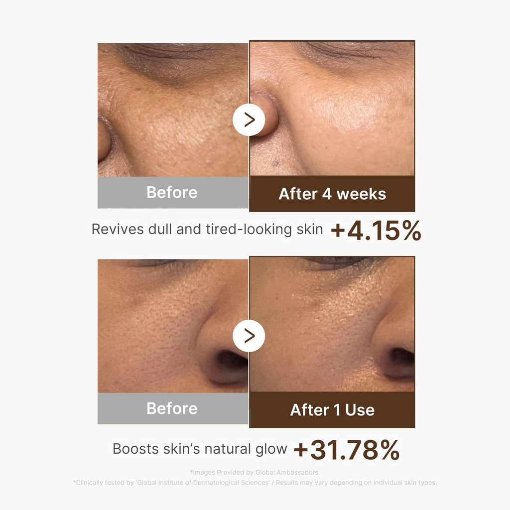 medicube Deep Vitamin C Capsule Serum, 1.01 fl.oz | Vitamin C Serum for Dull & Uneven-Looking Skin - Liposome Capsules for Smooth, Radiant Texture, Korean Skincare