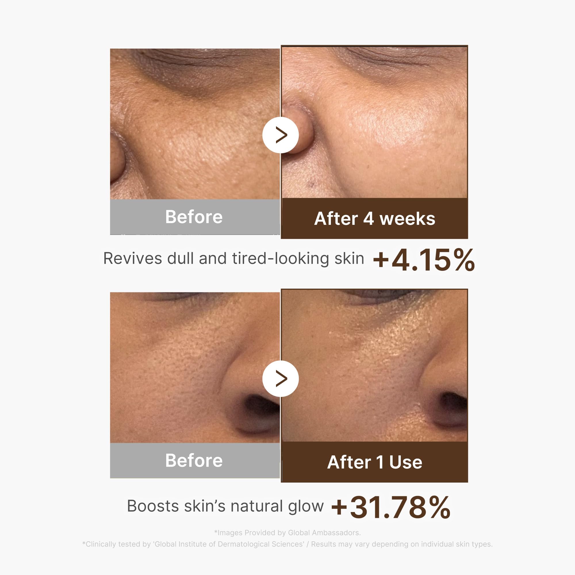 medicube Deep Vitamin C Capsule Serum, 1.01 fl.oz | Vitamin C Serum for Dull & Uneven-Looking Skin - Liposome Capsules for Smooth, Radiant Texture, Korean Skincare