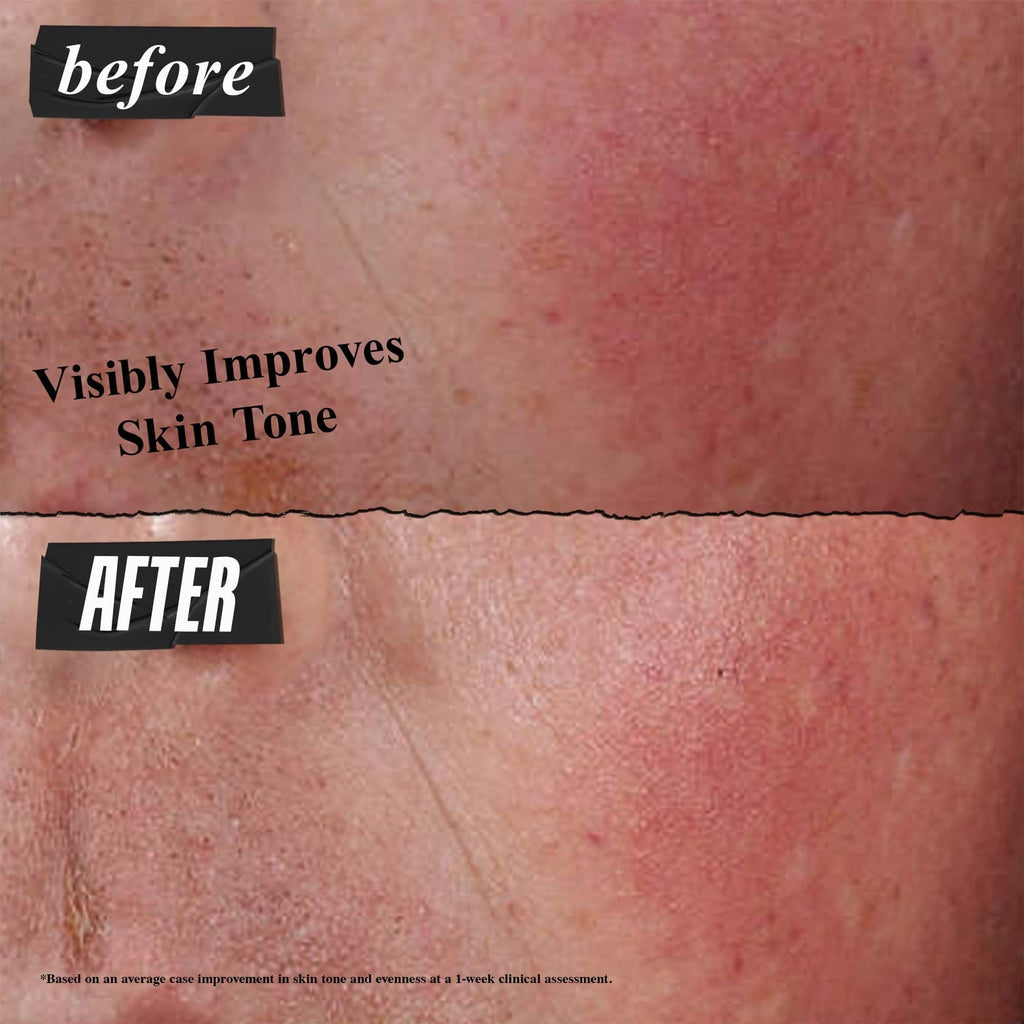 Buy now Kiehl's Ultra Facial Advanced Repair Barrier Cream, Intensive Treatment Relieves Dry + Sensitive Skin, Rapidly Reduces Redness and Soothes, Fast-Absorbing Breathable Formula, Paraben-Free - 1.7 fl oz at indiglob india