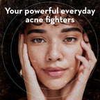 Korean Pimple Patches for Face (132 Dots) - Hydrocolloid Acne Patches & Zit Patches with Tea Tree Oil - Invisible Blemish Patches - Dermatologist Tested Korean Skin Care