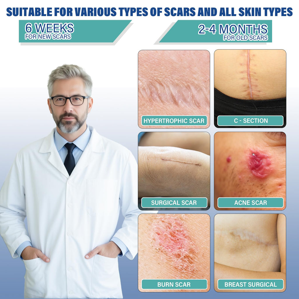 Silicone Scar Sheets, Silicone Scar Tape(1.6"x 158" Roll-4 meters), Silicone Scar Sheets for Surgical Scars, Scar Tape for Surgical, C-Section, Burn, Hypertrophic & Keloid Scars