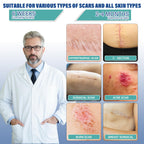 Silicone Scar Sheets, Silicone Scar Tape(1.6"x 158" Roll-4 meters), Silicone Scar Sheets for Surgical Scars, Scar Tape for Surgical, C-Section, Burn, Hypertrophic & Keloid Scars