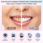 2Pack Niacinamide Whitening Toothpaste, Niacinamide Intensive Toothpaste, Fresh Breath, 7.6 Oz