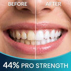Teeth Whitening Gel with Trays 44% Carbamide Peroxide 5 Syringes - 50+ Uses