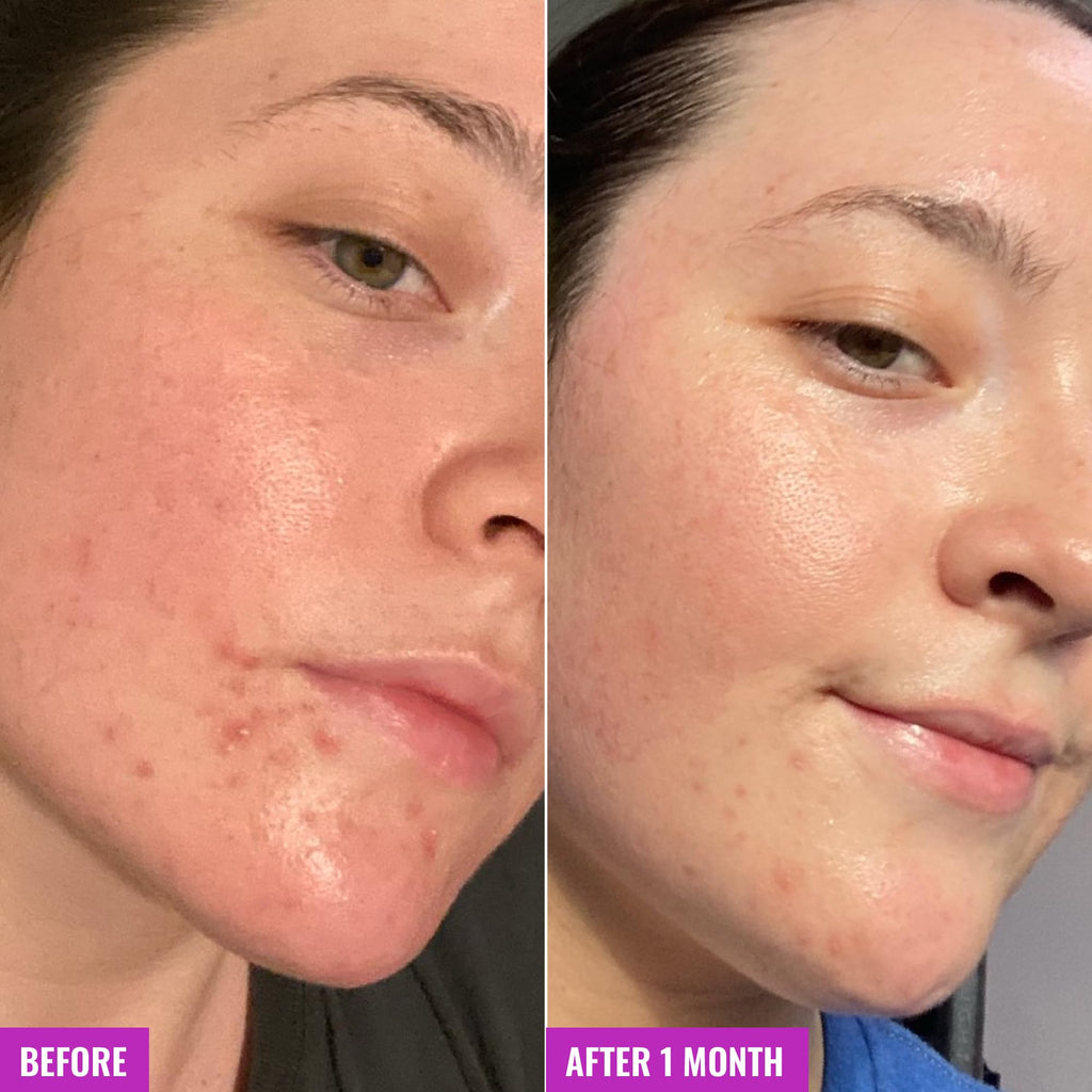 Good Molecules Clarify and Cleanse Bar, Salicylic Acid Bar Soap, 3.15 oz | Soap-free cleansing bar with salicylic acid, kaolin clay, and cacao for blemish-prone skin.