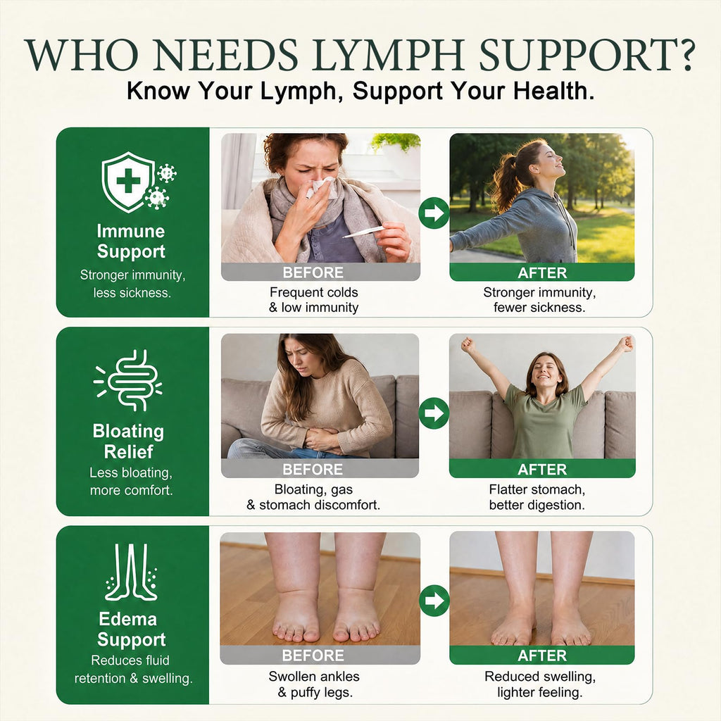Lymphatic Drainage–Lymphatic Drainage Drops Cleanse & Bloat Relief Supports Lymphatic Health (2 Fl Oz)