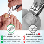 Toenail Clippers for Thick Toenails – KLIPP 15 mm Wide Jaw Thick Fingernail and Toenail Cutter with Curved Stainless-Steel Blades for Seniors (Eagle Beak)