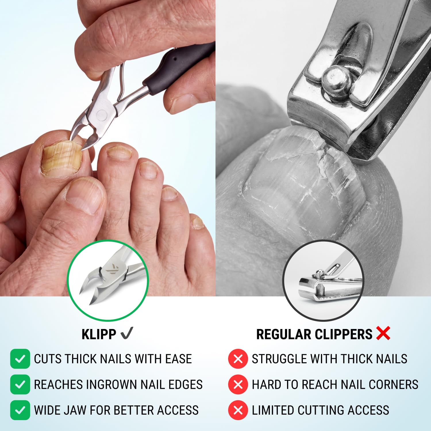 Toenail Clippers for Thick Toenails – KLIPP 15 mm Wide Jaw Thick Fingernail and Toenail Cutter with Curved Stainless-Steel Blades for Seniors (Eagle Beak)