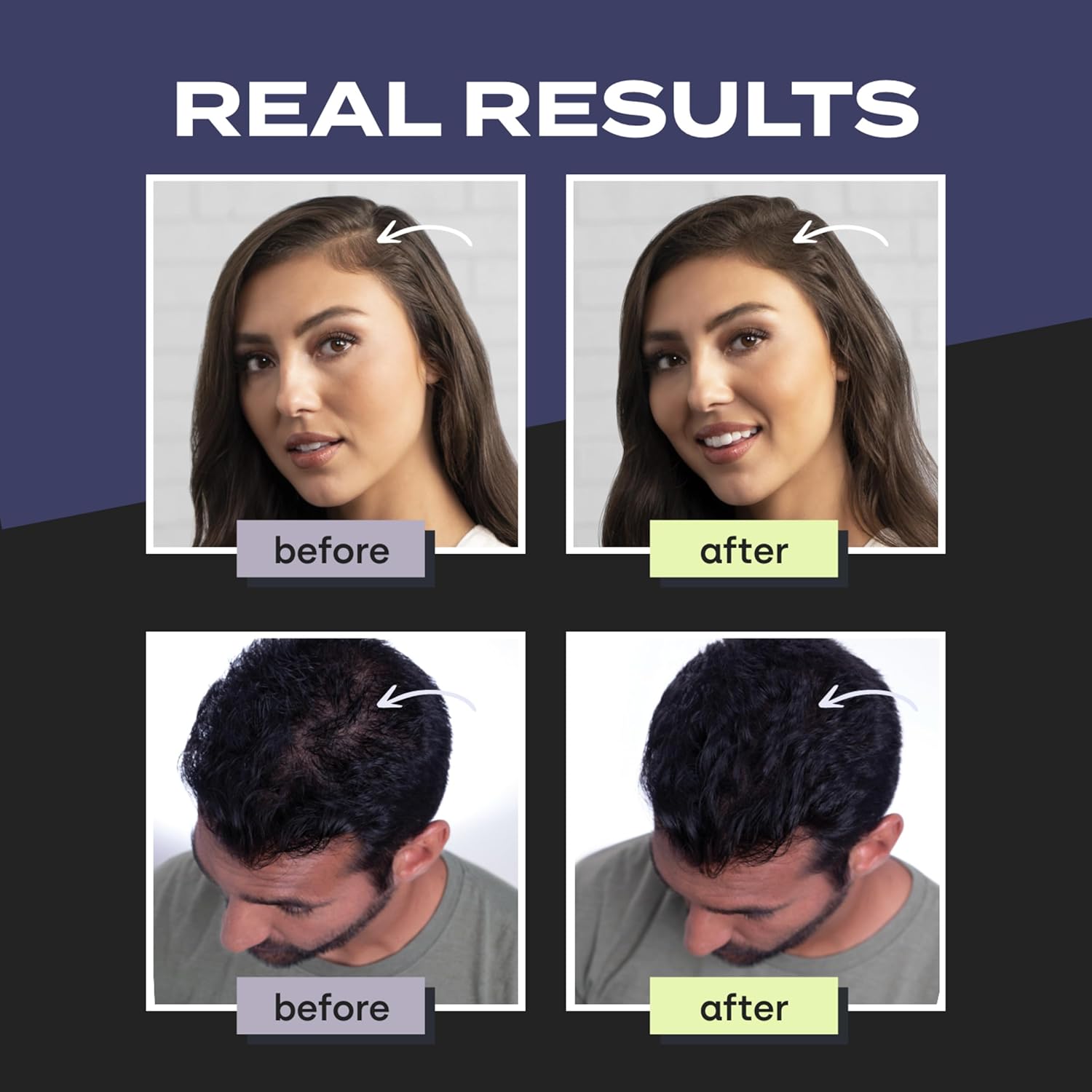 Buy now Toppik Hair Building Fibers, Fill In Fine or Thinning Hair Instantly Thicker, Fuller Looking Hair 9 Shades,4 size options at indiglob india