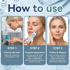 Picdo 7 Day Spot and Tag Removal Pen, Beauty Rollerball Pen, Picdo 7-Day Tag & Spot Eraser with Salicylic Acid, Moisturizes and Nourishes