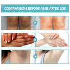 Acanthosis Nigricans Therapy Cream,Dark Spot Remover For Body,Dark Spot Corrector Cream,- Underarm, Neck, Armpit, Knees, Elbows, Private Areas, Intimate Areas - Upgraded Formula, - 2.1Fl Oz