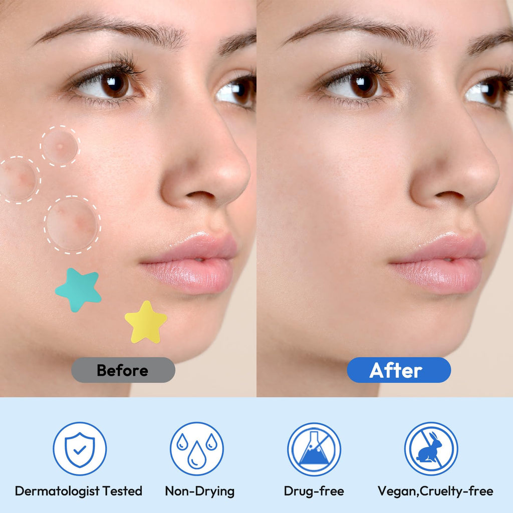 Pimple Patches for Face 335 Patches-255 Round & 80 Star Cute Coloful Acne Patches,Hydrocolloid Pimple Patch Colorful Spot Stickers w/Tea Tree, Salicylic Acid & Cica Oil| Classic & Fashion Zit Covers