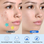 Pimple Patches for Face 335 Patches-255 Round & 80 Star Cute Coloful Acne Patches,Hydrocolloid Pimple Patch Colorful Spot Stickers w/Tea Tree, Salicylic Acid & Cica Oil| Classic & Fashion Zit Covers