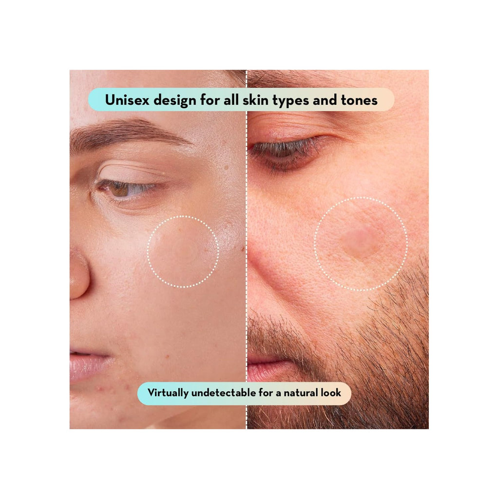 Korean Pimple Patches for Face (132 Dots) - Hydrocolloid Acne Patches & Zit Patches with Tea Tree Oil - Invisible Blemish Patches - Dermatologist Tested Korean Skin Care