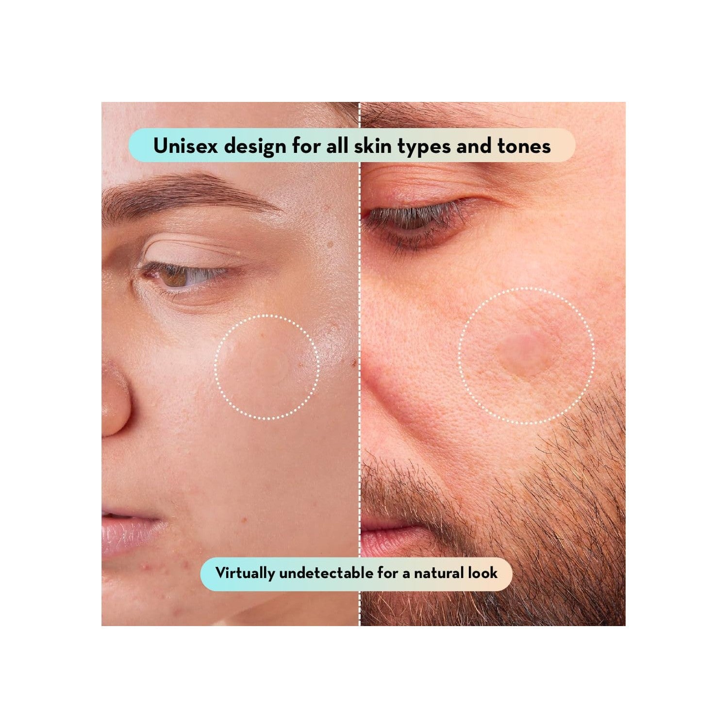Korean Pimple Patches for Face (132 Dots) - Hydrocolloid Acne Patches & Zit Patches with Tea Tree Oil - Invisible Blemish Patches - Dermatologist Tested Korean Skin Care