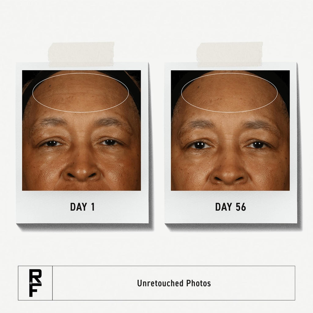 RODAN + FIELDS Redefine Overnight Restorative Cream | Step 3 PM | Anti Aging Face Moisturizer for Deep Wrinkles & Fine Lines | Firms & Tightens Skin | Night Face Cream | Glycolic Acid & Bakuchiol