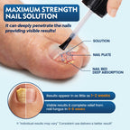 Toenail Fungus Treatment Extra Strength, Nail Fungus Treatment for Thick, Discolored Fungi Nails - 25% Undecylenic Acid All-in-One Kit with 30ML Fungi Nail Solution, 2 Nail Repair Pens
