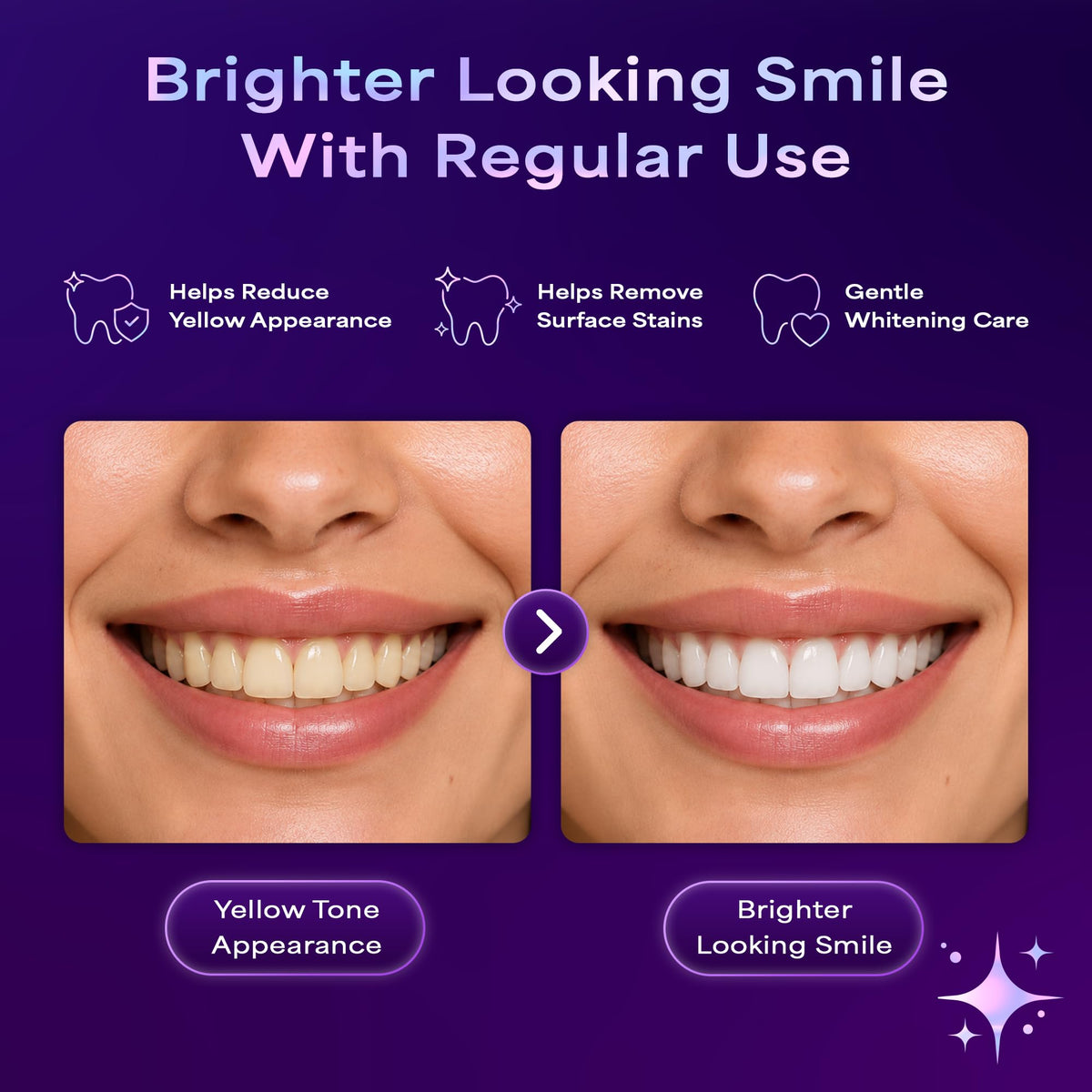 Purple Teeth Whitening Strips - 42 Count - Peroxide Free Color Correcting Whitening Strips - At Home Smile Care Kit