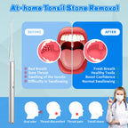 Easy Tonsil Stone Remover- Electronic Tonsil Stone Removal Kit with Aluminum Alloy Body, Built-in LED Light & Flexible Probe - Painless Tonsillolith Remover Tool for Bad Breath - Rechargeable