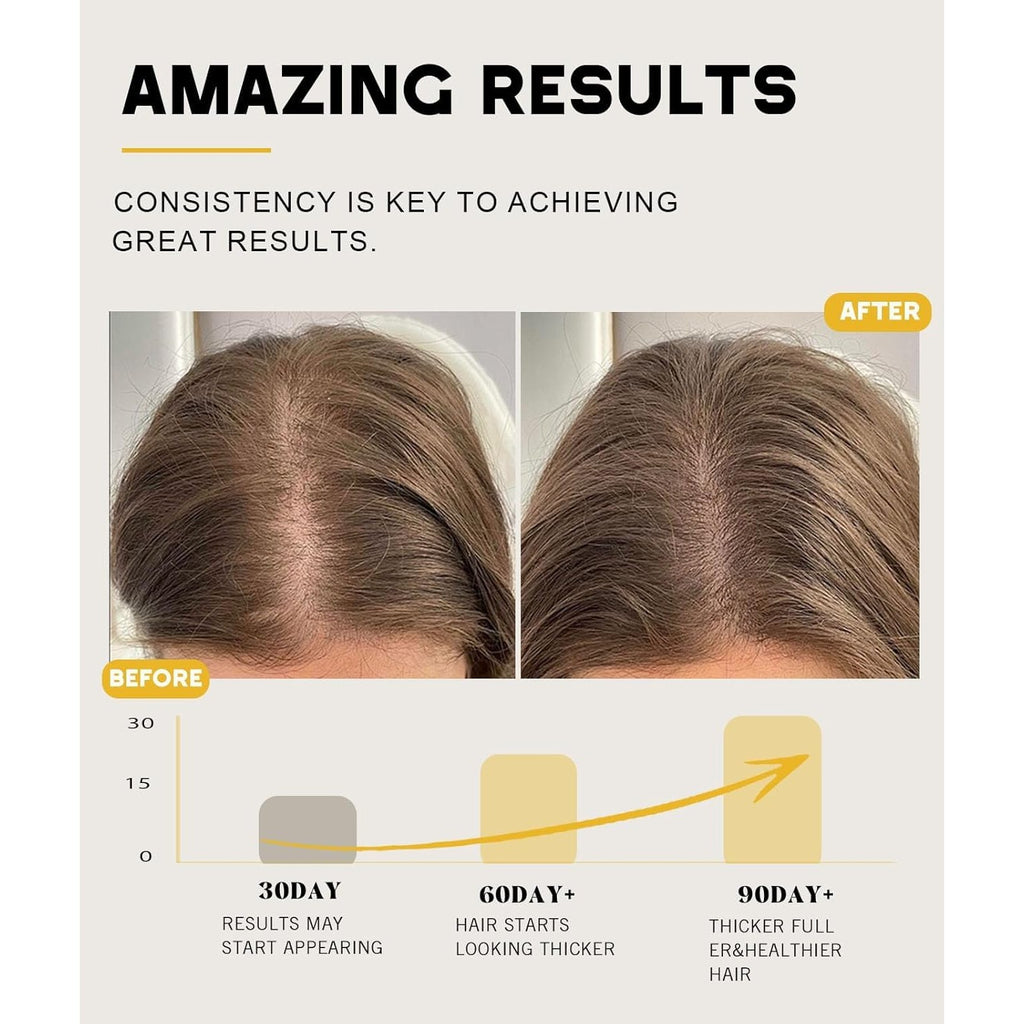 Batana Oil for Hair Growth, 100% Natural Pure Batana Oil Paste from Dr. Sebi Honduras, Prevents Hair Loss, Enhances Thickness, Organic Raw Scalp Mask for Women & Men (4.05 Oz)