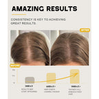 Batana Oil for Hair Growth, 100% Natural Pure Batana Oil Paste from Dr. Sebi Honduras, Prevents Hair Loss, Enhances Thickness, Organic Raw Scalp Mask for Women & Men (4.05 Oz)
