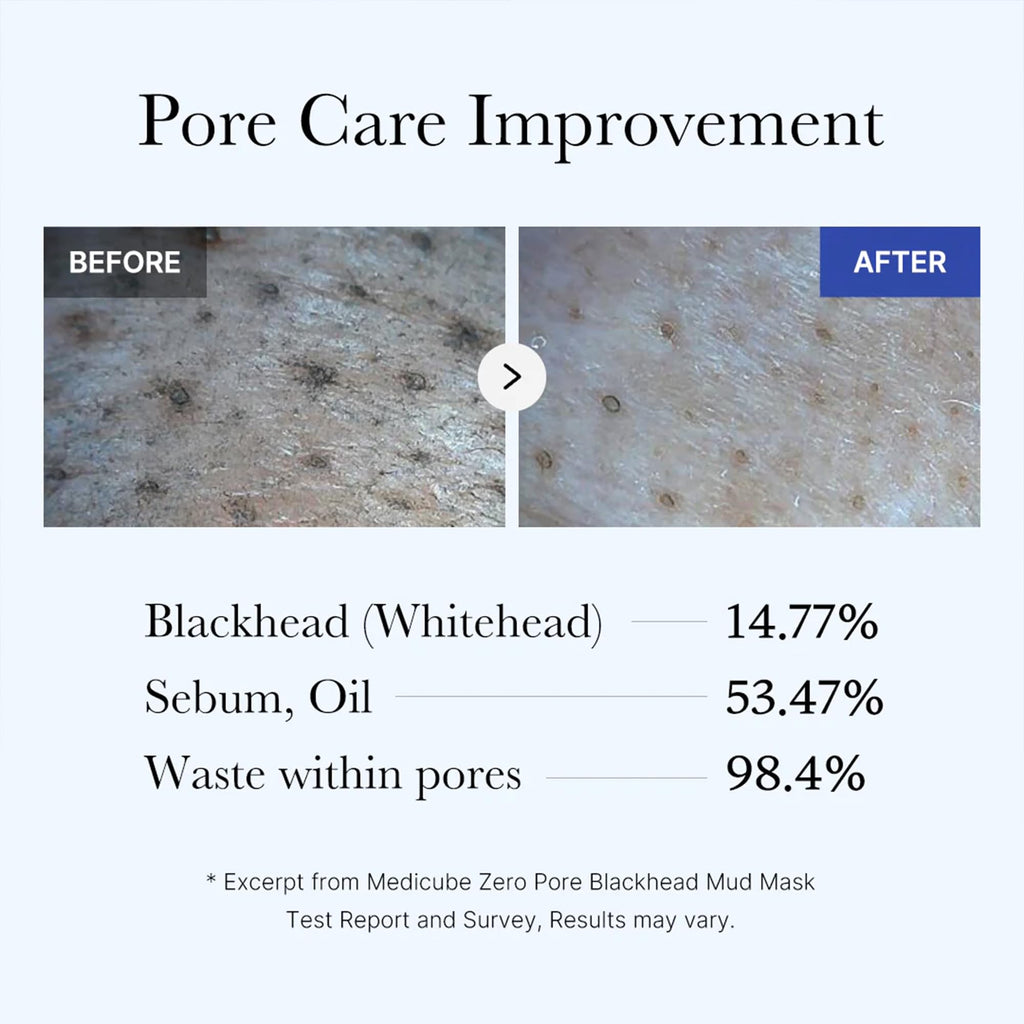 medicube Zero Pore Blackhead Mud Mask - Pore Cleansing & Gentle Exfoliating | Blackhead-Removing Clay Mask with AHA BHA PHA, Pore Minimizing & Cooling Care, 3 Min Quick Dry, Korean Skincare 3.52 oz.