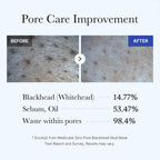 medicube Zero Pore Blackhead Mud Mask - Pore Cleansing & Gentle Exfoliating | Blackhead-Removing Clay Mask with AHA BHA PHA, Pore Minimizing & Cooling Care, 3 Min Quick Dry, Korean Skincare 3.52 oz.