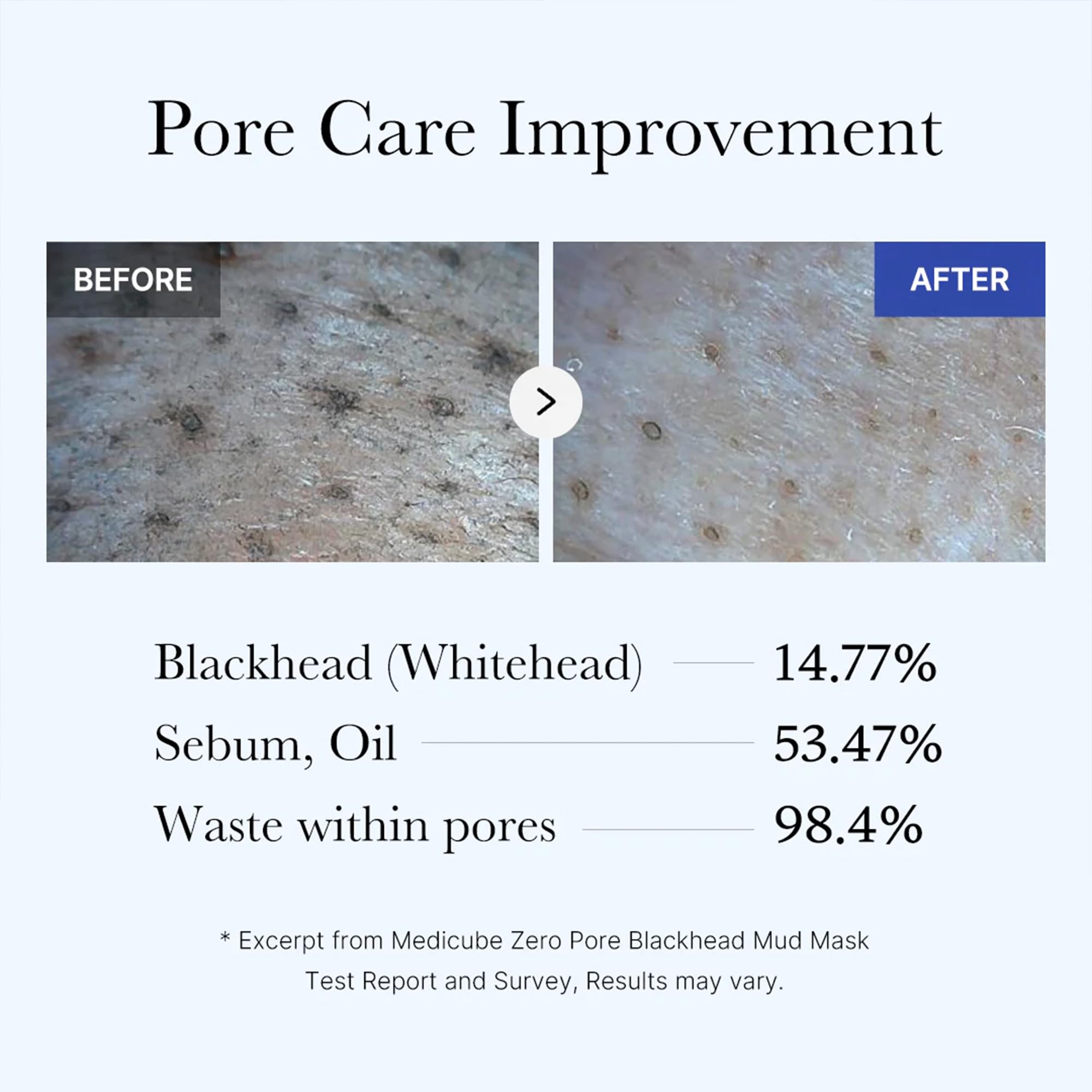 medicube Zero Pore Blackhead Mud Mask - Pore Cleansing & Gentle Exfoliating | Blackhead-Removing Clay Mask with AHA BHA PHA, Pore Minimizing & Cooling Care, 3 Min Quick Dry, Korean Skincare 3.52 oz.
