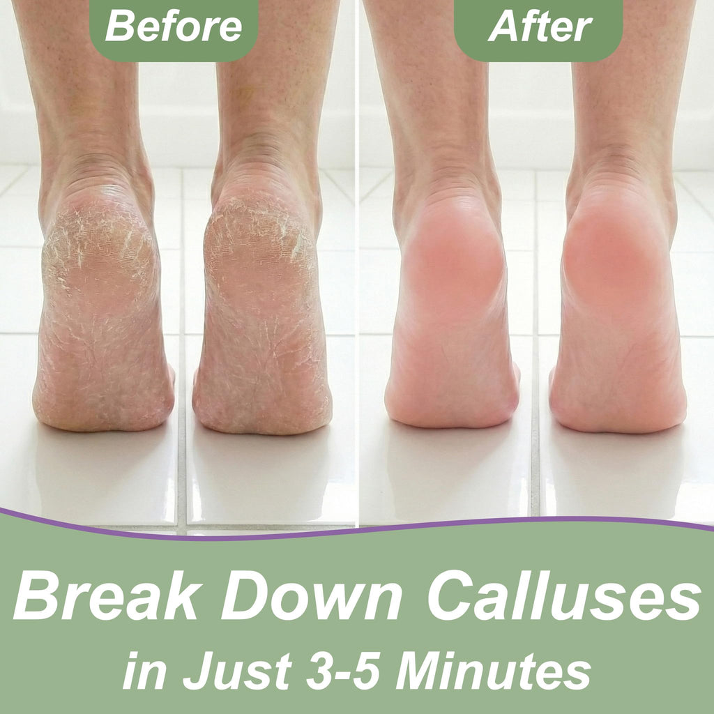 Foot Callus Remover Gel & File, 8 oz Extra Strength Callus Remover for Feet | Easily Softens and Removes Dead Hard Skin on Heels & Feet, Salon Results at Home in Minutes, Double-Sided Rasp Pedicure Tool