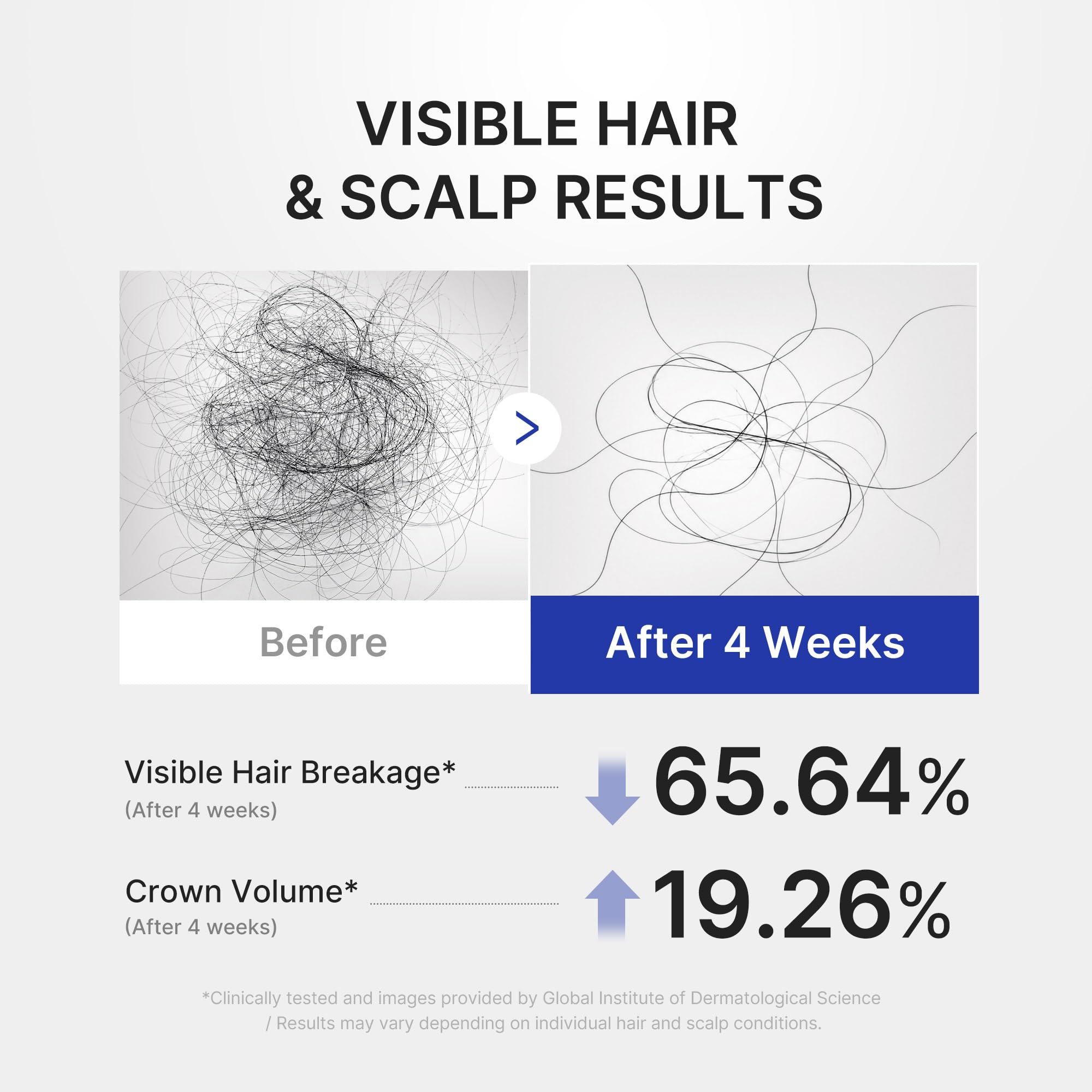 medicube Scalp Serum with Deoxyribose for Fuller Looking Hair | Fuller-Looking, Scalp Strengthening Care - Biotin, Rosemary, EGF, Caffeine, Fine, Thin-Looking Hair, Korean Hair Care, 20ml