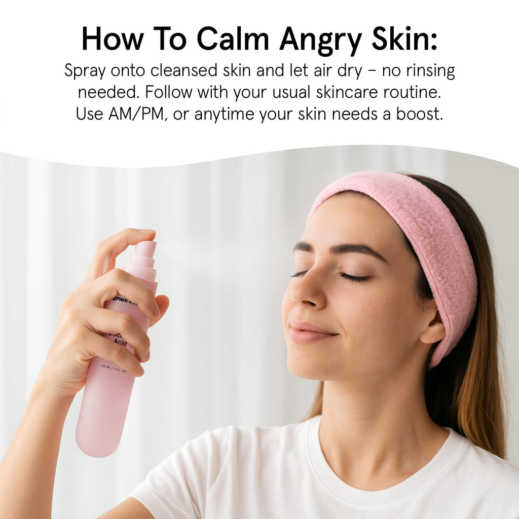 grace & stella Hypochlorous Acid Spray for Face - Acne Spray - Gentle Face Mist to Calm Redness, Flare-Ups, Breakouts, Body Acne, Bacne - Soothing Facial Mist for Sensitive Skin (120ml/4 fl oz)