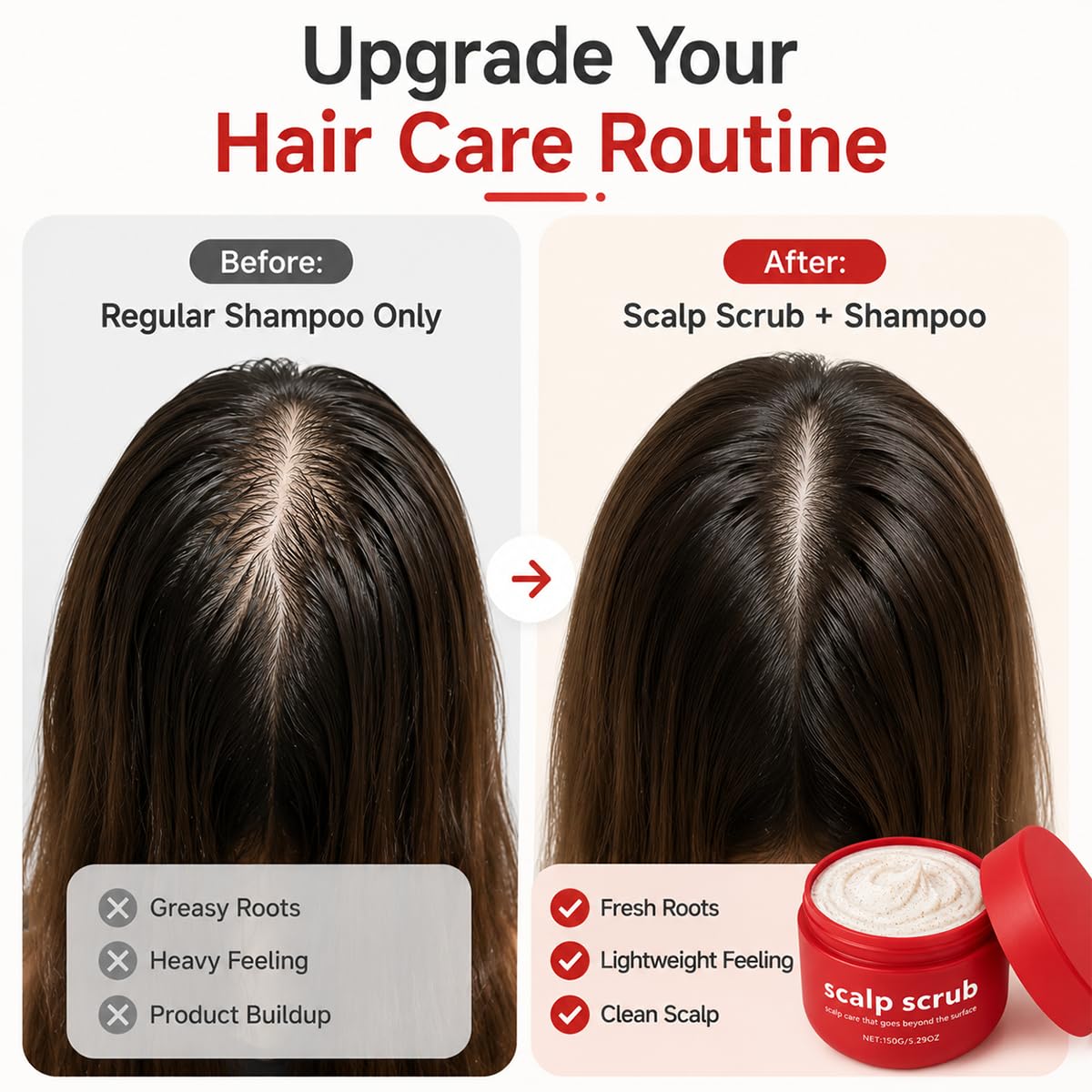 Exfoliating Scalp Scrub Psoriasis Red Jar for Women & Men, Scalp Detox Treatment with Gentle Scrub Particles, Removes Oil, Product Buildup & Dead Skin,Scalp Care for Healthy Looking Hair, 5.3 oz