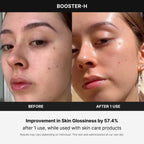 Buy now medicube Booster H - Korean Skincare Tool - Facial Glow Booster for Maximizing and Boosting Skin Care Absorption - Needle Free at indiglob india