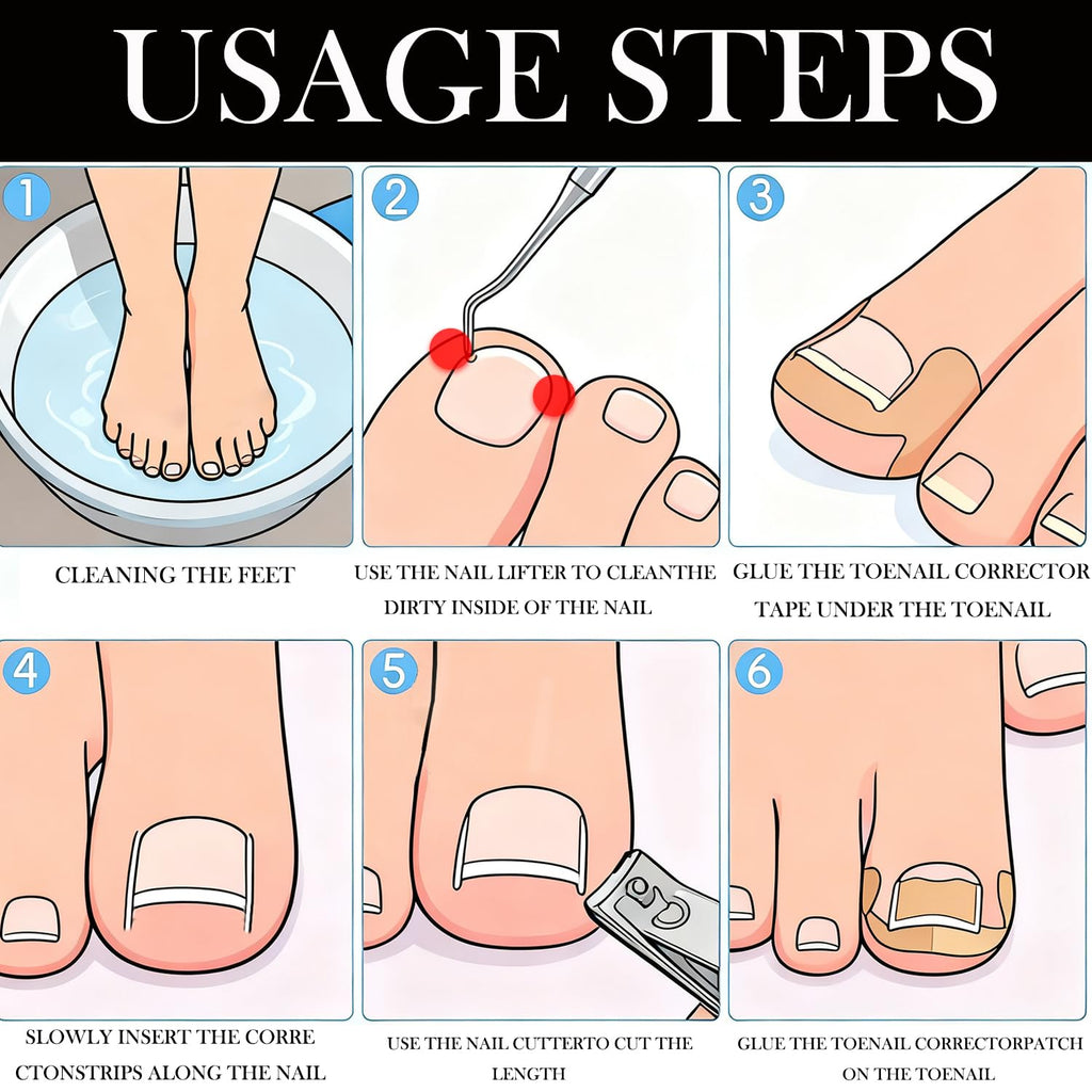 Professional Ingrown Toenail Toolkit, Ingrown Nail Corrector