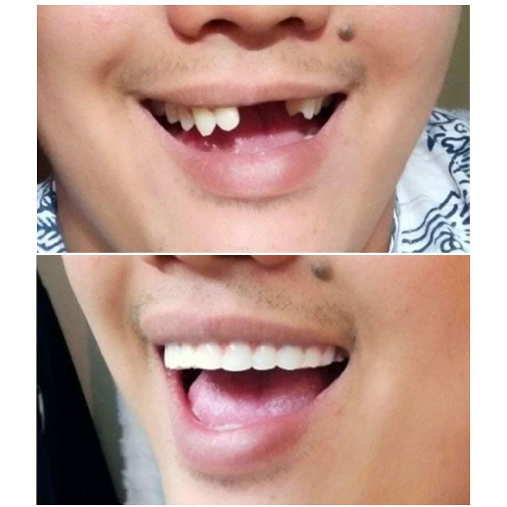 Buy now Instant Smile Comfort Fit Flex Natural Shade at indiglob india