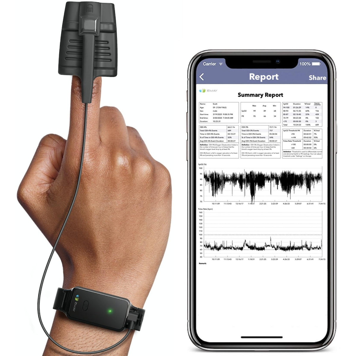 EMAY SleepO2 Wrist Pulse Oximeter with Recording Capability | Sleep Pulse Oximeter for Continuous O2 Recording | Not for Medical Use