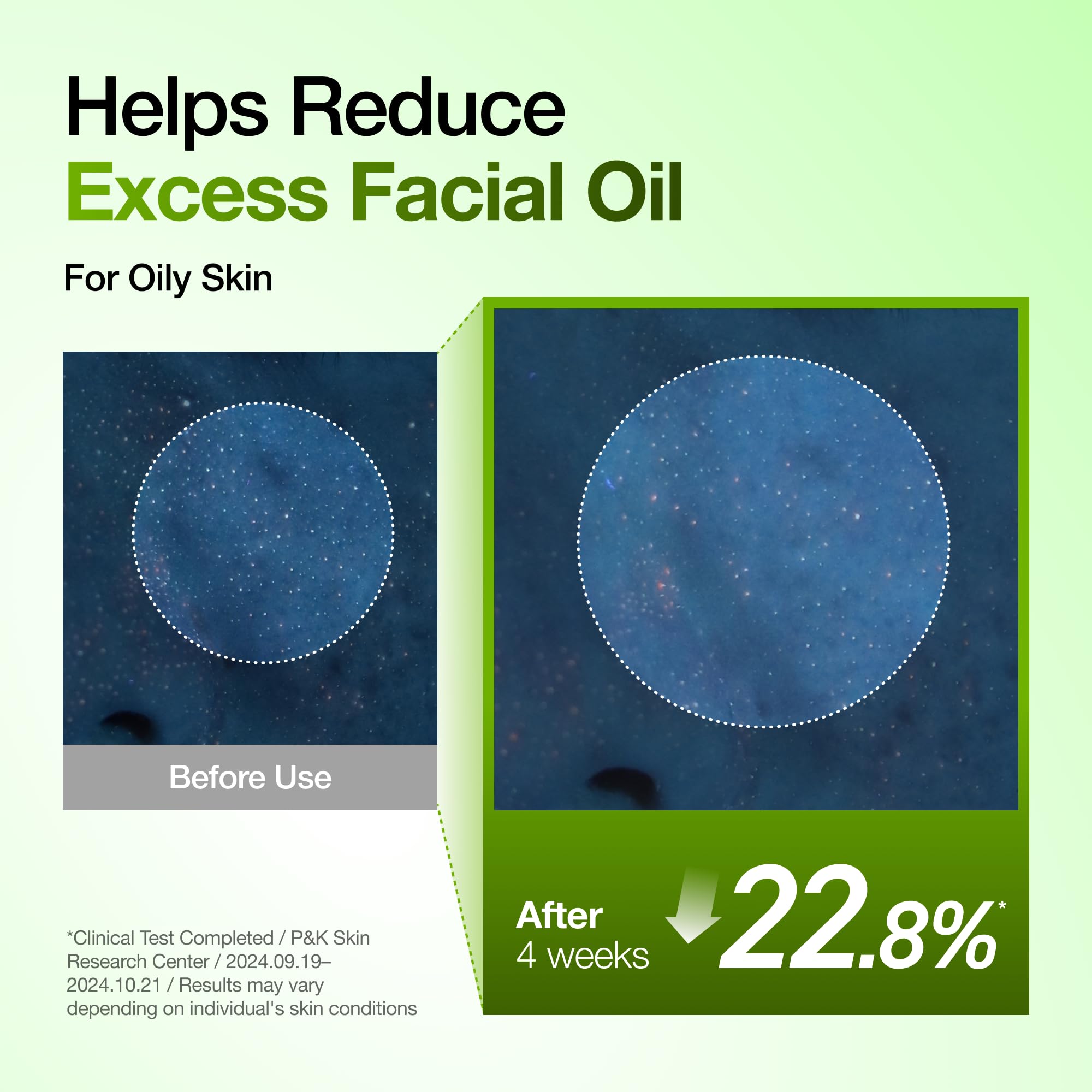 Anua Azelaic Acid 10 Hyaluron Redness Soothing Serum, 1.01 fl oz | Facial Serum for Blemish-Prone & Oily-Prone Skin, Lightweight & Hydrating Blemish Care, Hyaluronic Acid, Korean Skincare