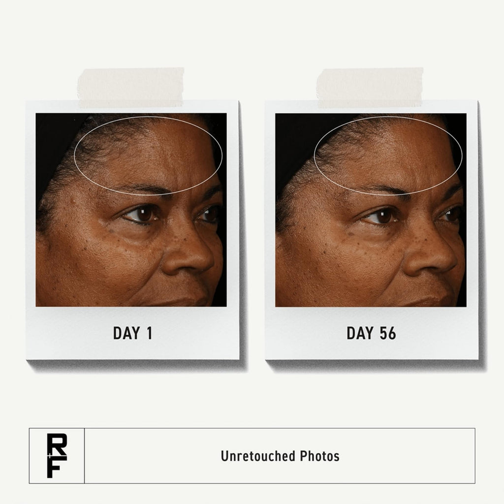 RODAN + FIELDS Redefine Overnight Restorative Cream | Step 3 PM | Anti Aging Face Moisturizer for Deep Wrinkles & Fine Lines | Firms & Tightens Skin | Night Face Cream | Glycolic Acid & Bakuchiol