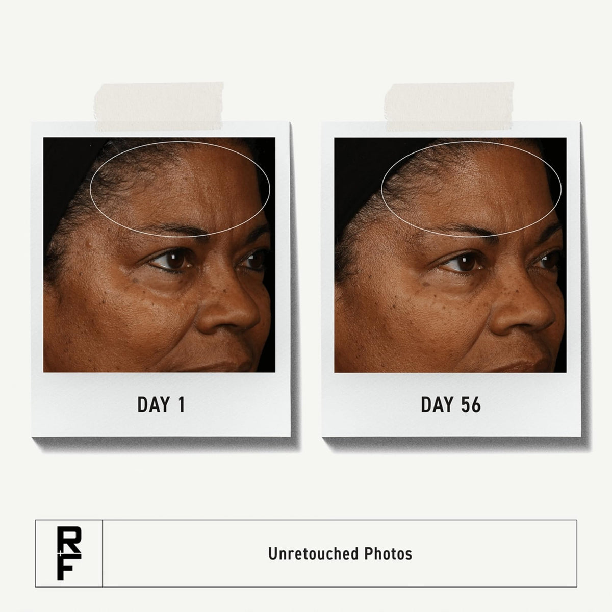 RODAN + FIELDS Redefine Overnight Restorative Cream | Step 3 PM | Anti Aging Face Moisturizer for Deep Wrinkles & Fine Lines | Firms & Tightens Skin | Night Face Cream | Glycolic Acid & Bakuchiol