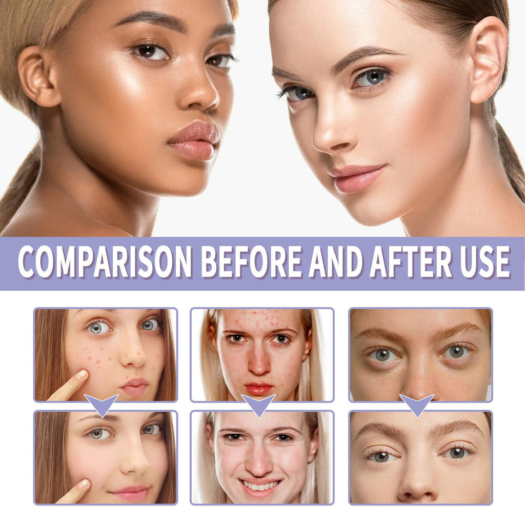Matte Foundation Powder, Jelly Setting Powder with Mini Puff, Powder-free Oil Control Face Pressed Powder Creates Long-Lasting Silky Blurring Waterproof Makeup