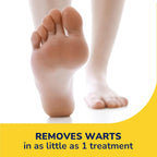 Buy now Dr. Scholl's Freeze Away Wart Remover for Hands & Feet, 12 ct â€“ Removes Warts Fast in as Little as 1 Treatment, Fast-Acting Treatment for Common and Plantar Wart Removal, Safe to Use on Kids Ages 4+ at indiglob india