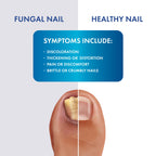 Fungal Shield Max Strength Brush-On Antifungal Liquid, 2-Pack