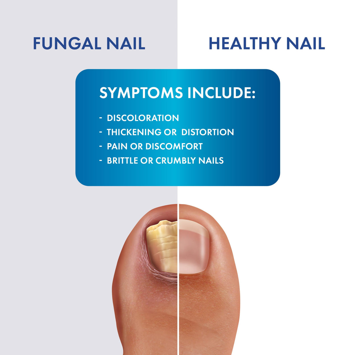 Fungal Shield Max Strength Brush-On Antifungal Liquid, 2-Pack