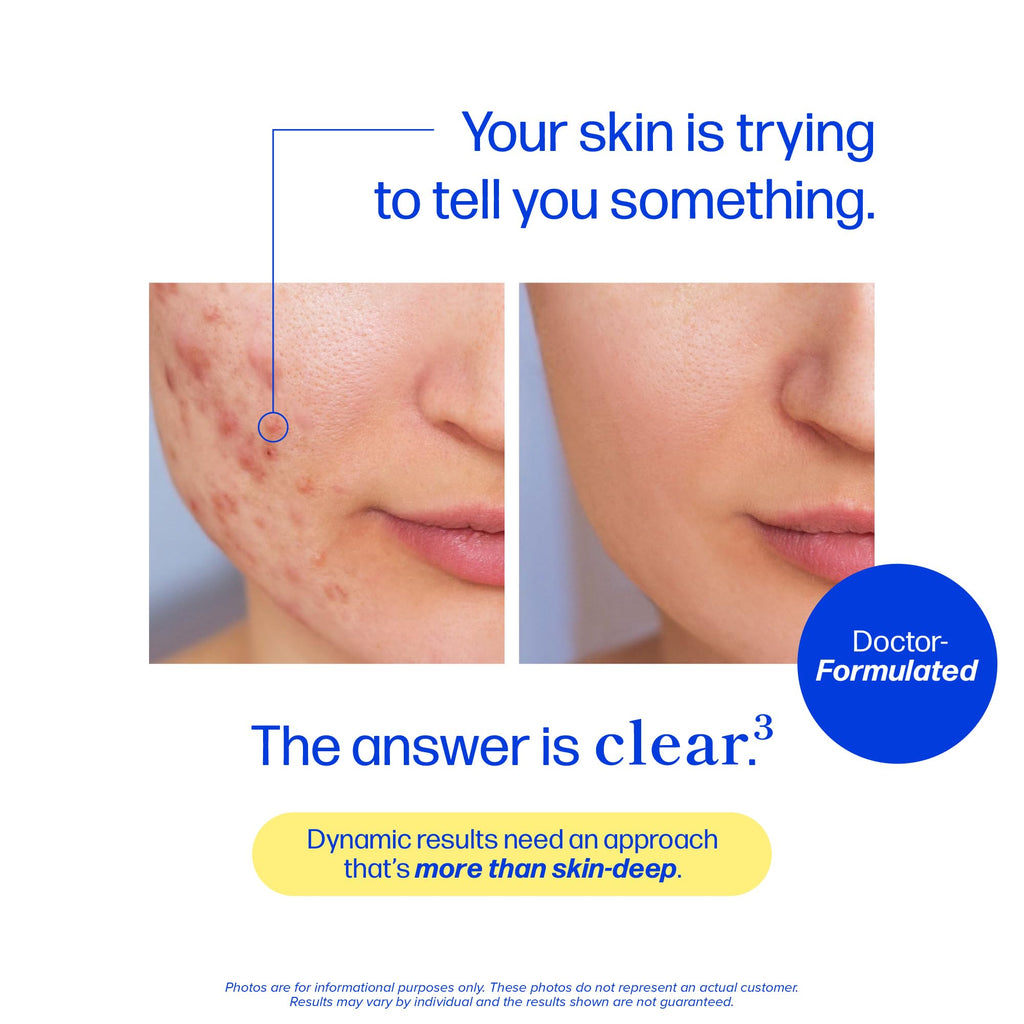 Clear Skin Supplement Acne Support, Zinc DIM, Probiotics, Doctor-Formulated | 3-in-1 Hormone, Gut & Complexion Support, Triple Action Hyaluronic Acid & Vitamins for Skin Balance and Glow, 180 Capsules