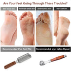 2 Pack Pedicure Kit, Foot File Callus Remover, Heel Scraper for Feet | Stainless Steel Foot Rasp & Wood Handle Callus Shaver (10 Replacements and 1 File Foot Head), Callus Remover for Feet